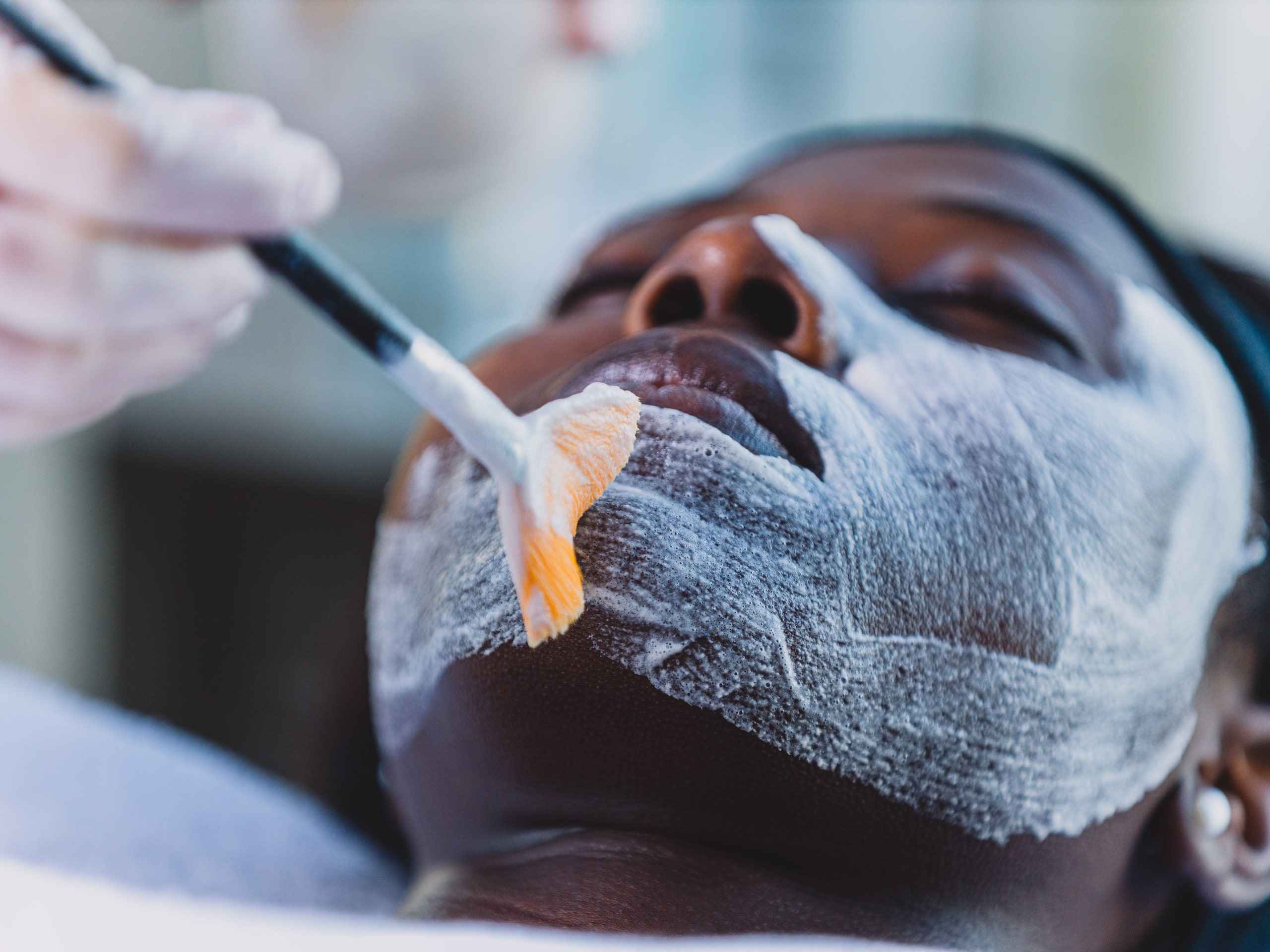 10 Things You Should Know Before Getting a Glycolic Acid Peel